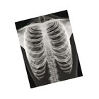 Röntgenbilder - Mensch, 18 Detailaufnahmen, ab 6 Jahre