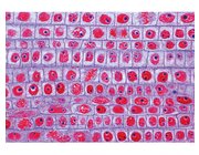 Zellteilung/Mitose - 15 Mikropr�parate im Kasten, ab 10 Jahre