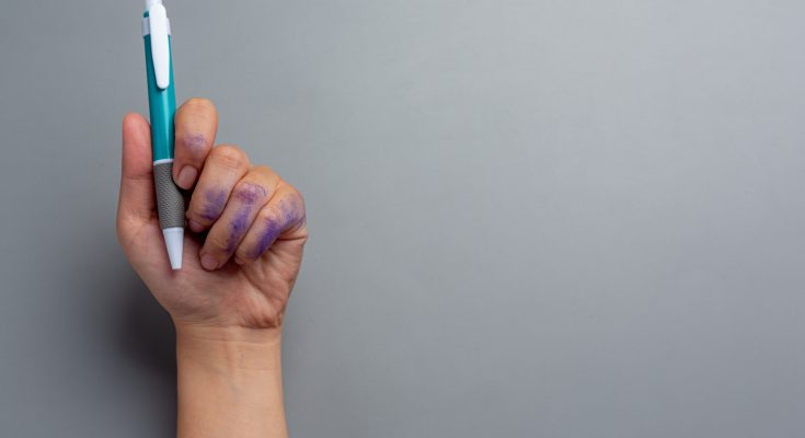 Eine Hand hält einen blauen Kugelschreiber, während die Finger von lila Tinte verschmiert sind. Der Hintergrund ist grau und neutral, was den Fokus auf den Stift und die Hand lenkt.